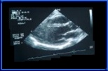 Herz-Ultraschall2